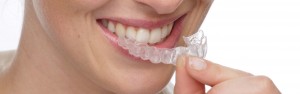 Orthodontie invisible - Invisalign